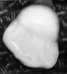 molars-smooth-glennphoto.jpg